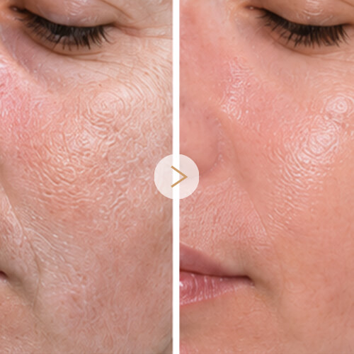 1-Hydration Improvement (1)