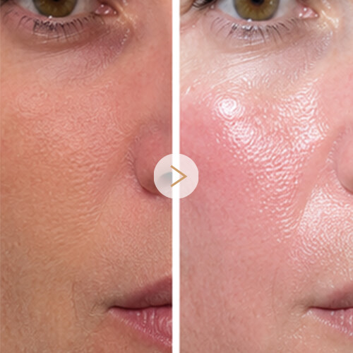 1-Skin Hydration Improvement (1)