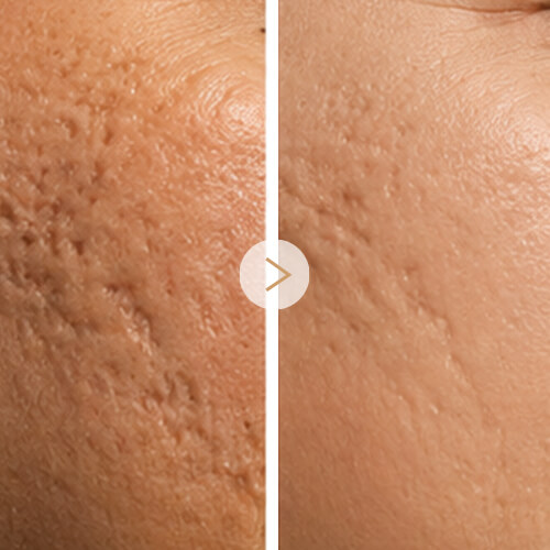 3-Texture Refinement (1)