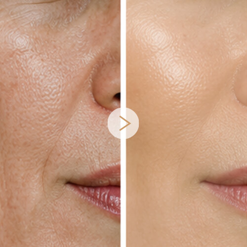 4-Radiance Enhancement (1)