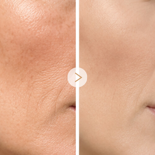 5-Overall Skin Quality (1)