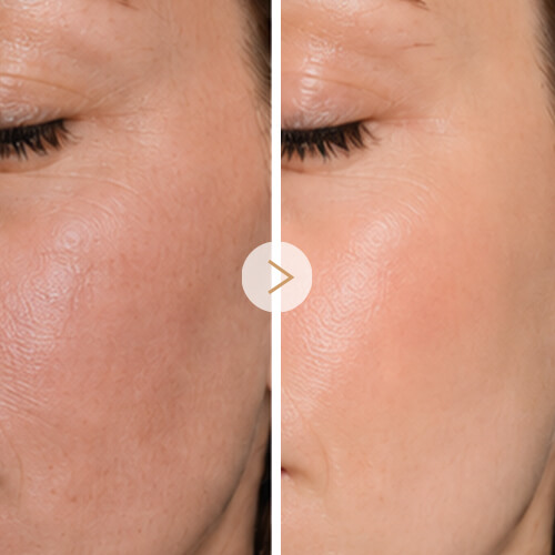 5-Overall Skin Quality (2) (1)